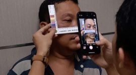 Endang korban dugaan penganiayaan saat menjalani visum. (Istimewa)