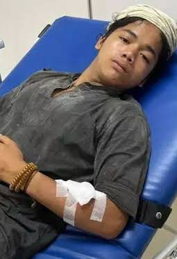 Kronologi Warga Baduy Jadi Korban Begal hingga Terluka di Jakarta