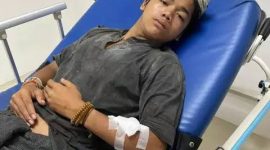 Repan saat menjalani perawatan medis. (FOTO ISTIMEWA)